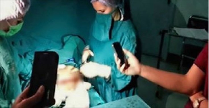 صورة لطبيبة تجري عملية جراحية على أضواء الهواتف: مدير المستشفى يوضح