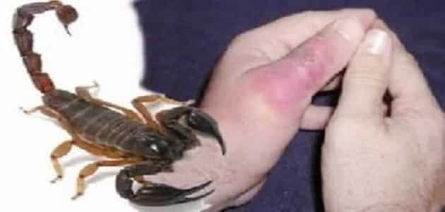 سليانة: وفاة طفلة في الثامنة من العمر بعد تعرضها للدغة عقرب